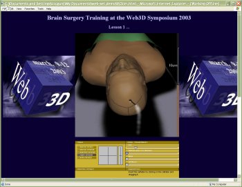 Web 3D Brain Surgery